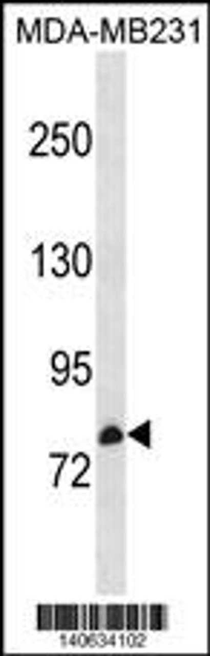 Western blot analysis in MDA-MB231 cell line lysates (35ug/lane) .