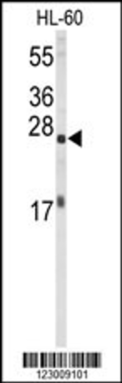 Western blot analysis of EIF4E Antibody in HL-60 cell line lysates (35ug/lane)