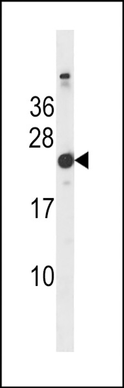 Western blot analysis in mouse bladder tissue lysates (35ug/lane) .