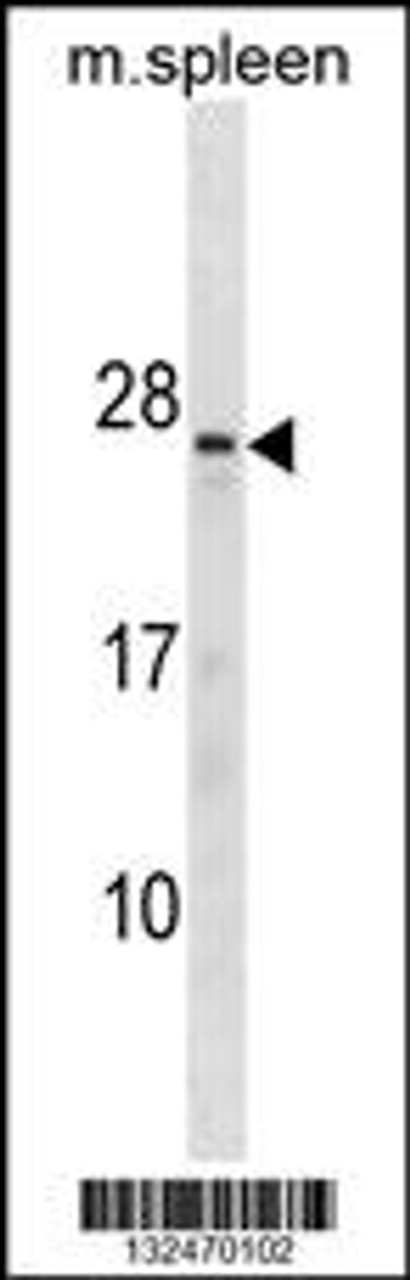 Western blot analysis in mouse spleen tissue lysates (35ug/lane) .