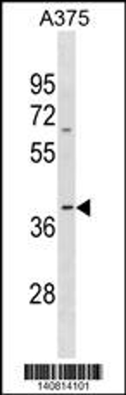 Western blot analysis in A375 cell line lysates (35ug/lane) .