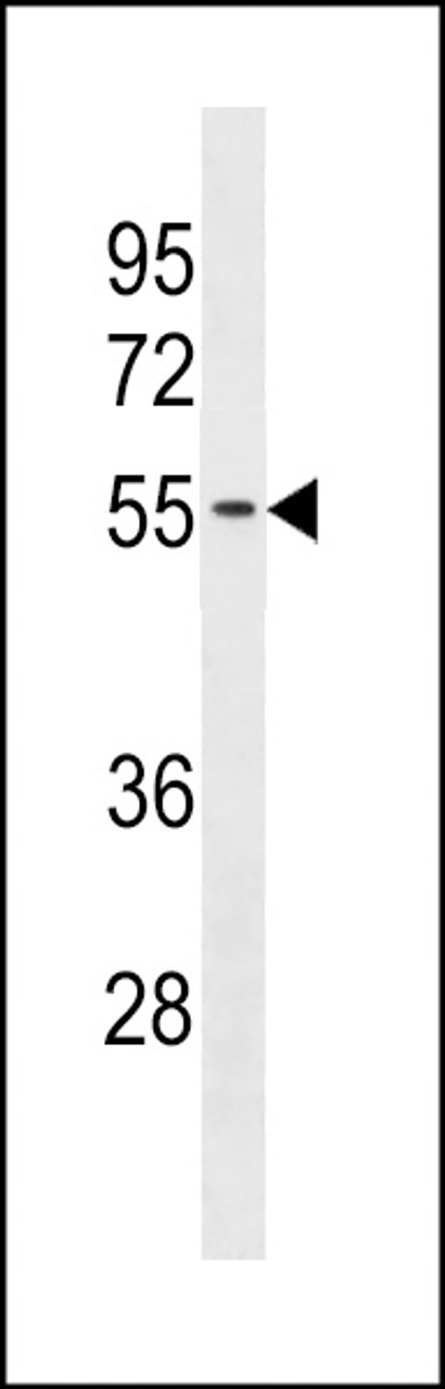 Western blot analysis in A2058 cell line lysates (35ug/lane) .