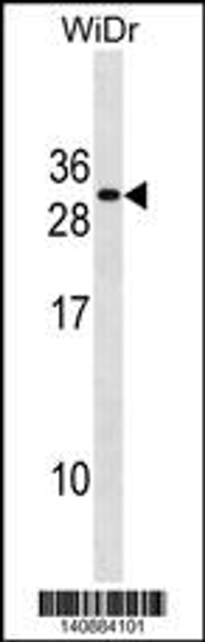 Western blot analysis in WiDr cell line lysates (35ug/lane) .