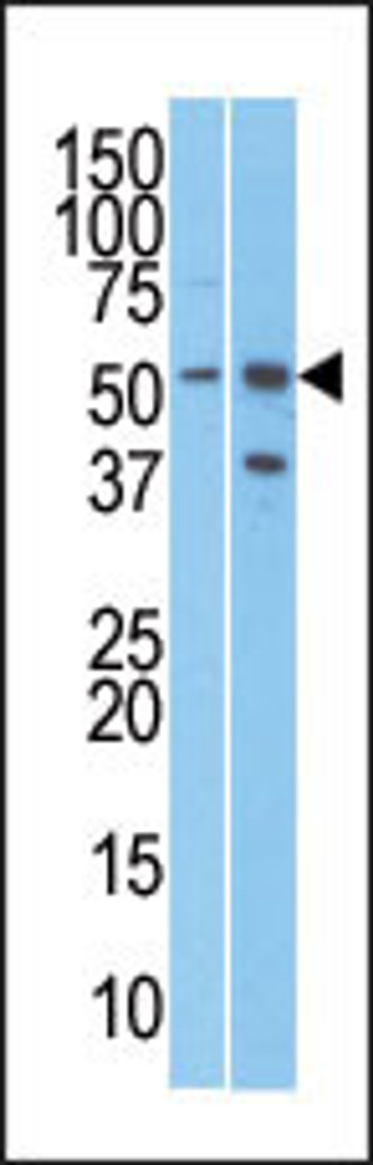 Antibody is used in Western blot to detect RMP in T47D (left) and Jurkat (right) cell line lysates.