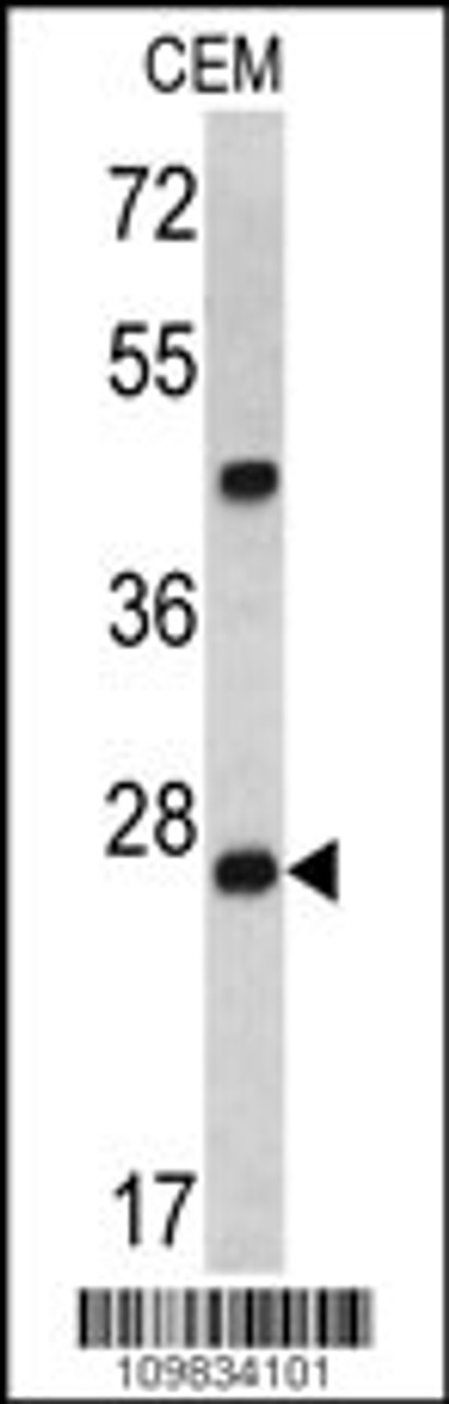 Western blot analysis of Dcr-1 antibody in CEM cell line lysates (35ug/lane)