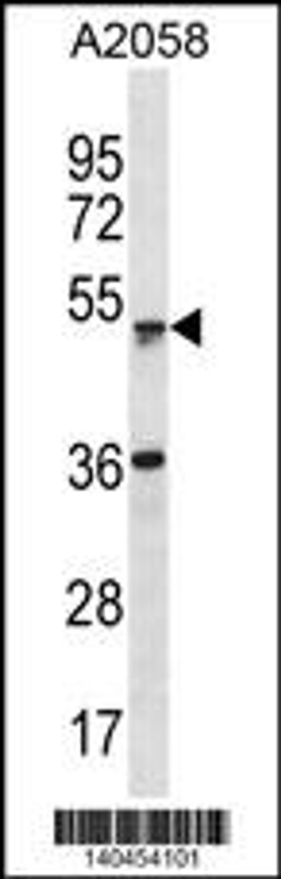 Western blot analysis in A2058 cell line lysates (35ug/lane) .