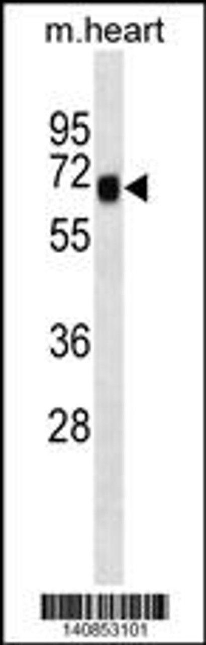 Western blot analysis in mouse heart tissue lysates (35ug/lane) .