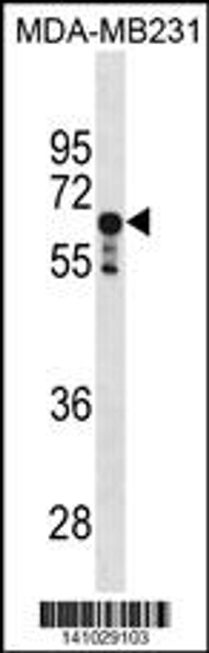 Western blot analysis in MDA-MB231 cell line lysates (35ug/lane) .