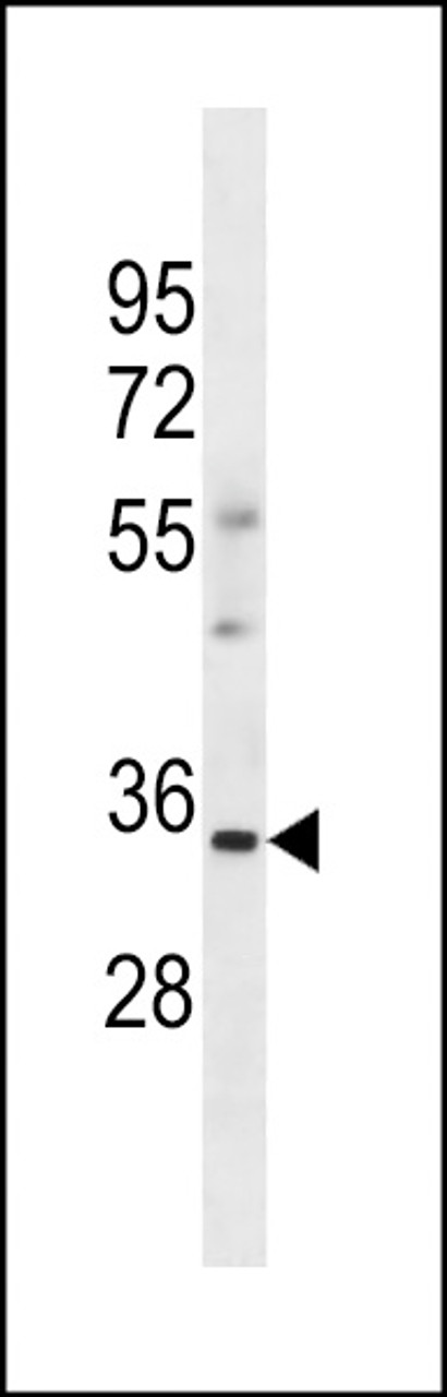 Western blot analysis in human Uterus tissue lysates (35ug/lane) .