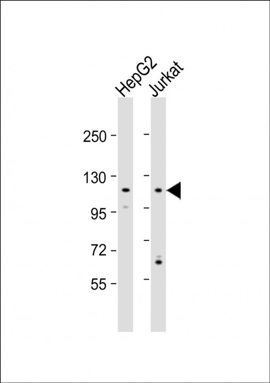 Western Blot at 1:1000 dilution Lane 1: HepG2 whole cell lysate Lane 2: Jurkat whole cell lysate Lysates/proteins at 20 ug per lane.