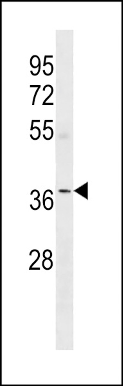 Western blot analysis in human Uterus tissue lysates (35ug/lane) .