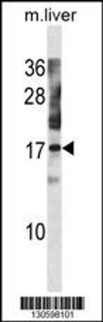 Western blot analysis in mouse liver tissue lysates (35ug/lane) .