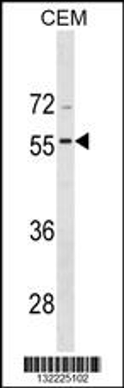 Western blot analysis in CEM cell line lysates (35ug/lane) .