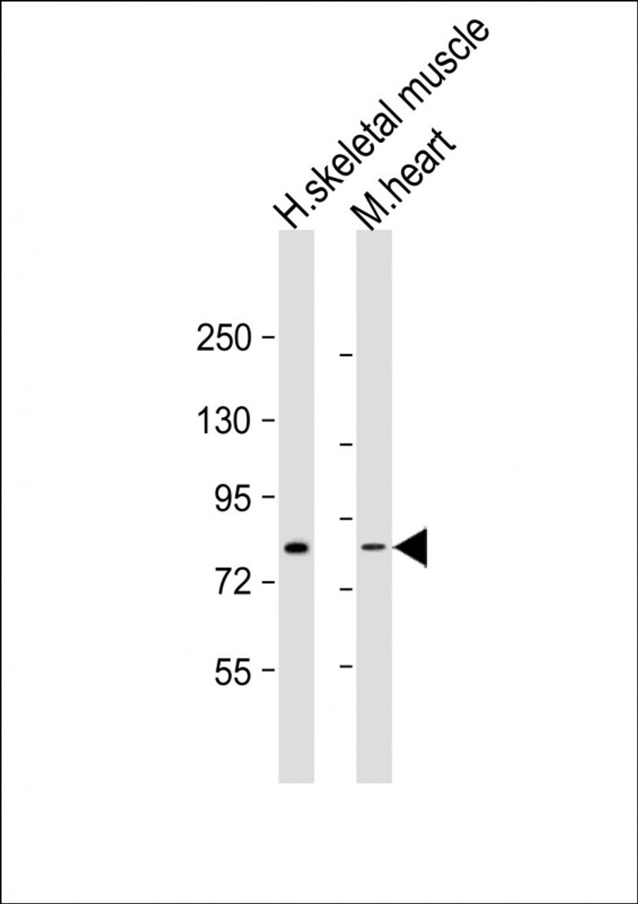 Western Blot at 1:1000-1:2000 dilution Lane 1: human skeletal muscle lysate Lane 2: mouse heart lysate Lysates/proteins at 20 ug per lane.