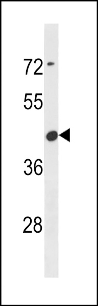 Western blot analysis in CEM cell line lysates (35ug/lane) .