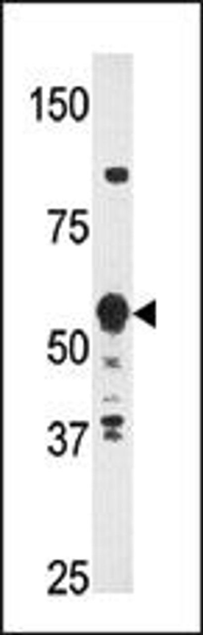 Western blot analysis of anti-HDBP2 (HDRF-2) Antibody in Y79 cell line lysates (35ug/lane) .