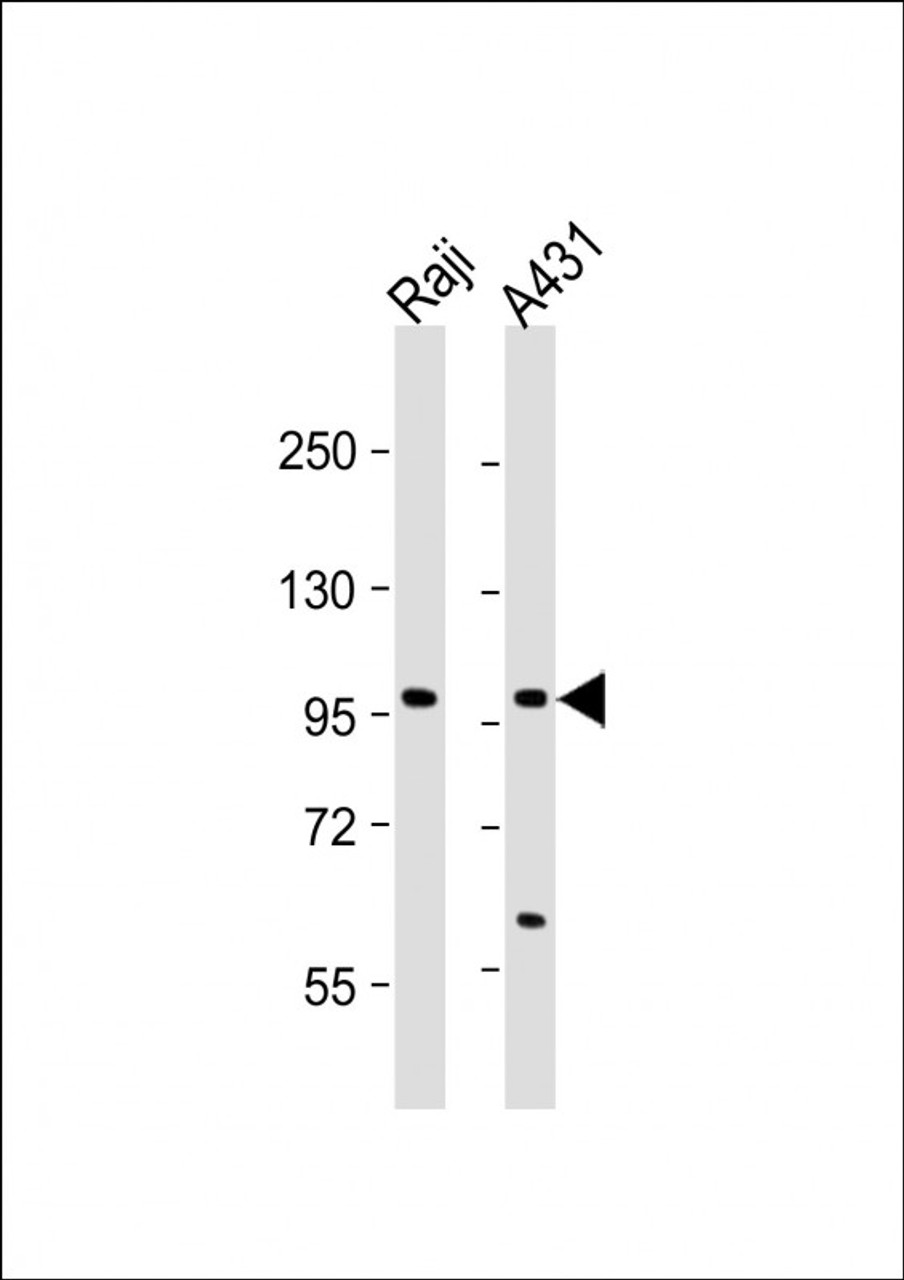Western Blot at 1:1000 dilution Lane 1: Raji whole cell lysate Lane 2: A431 whole cell lysate Lysates/proteins at 20 ug per lane.