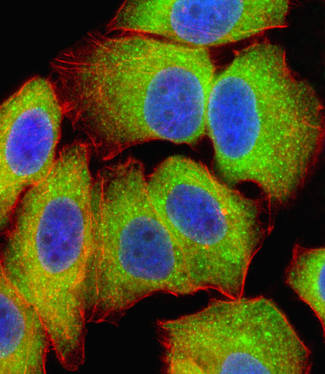 Fluorescent confocal image of U251 cell stained with RELA Antibody .U251 cells were fixed with 4% PFA (20 min) , permeabilized with Triton X-100 (0.1%, 10 min) , then incubated with RELA primary antibody (1:25) . For secondary antibody, Alexa Fluor 488 conjugated donkey anti-rabbit antibody (green) was used (1:400) .Cytoplasmic actin was counterstained with Alexa Fluor 555 (red) conjugated Phalloidin (7units/ml) . Nuclei were counterstained with DAPI (blue) (10 ug/ml, 10 min) .RELA immunoreactivity is localized to Cytoplasm significantly.
