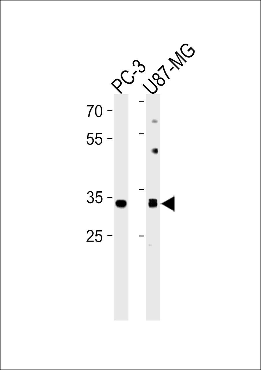 Western blot analysis in PC-3，U87-MG cell line lysates (35ug/lane) .This demonstdetected the JUN protein (arrow) .