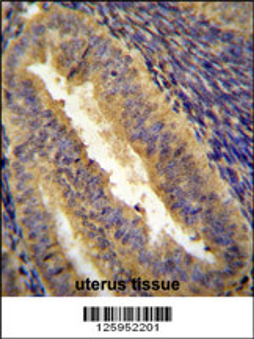 JUN Antibody immunohistochemistry analysis in formalin fixed and paraffin embedded human uterus tissue followed by peroxidase conjugation of the secondary antibody and DAB staining.