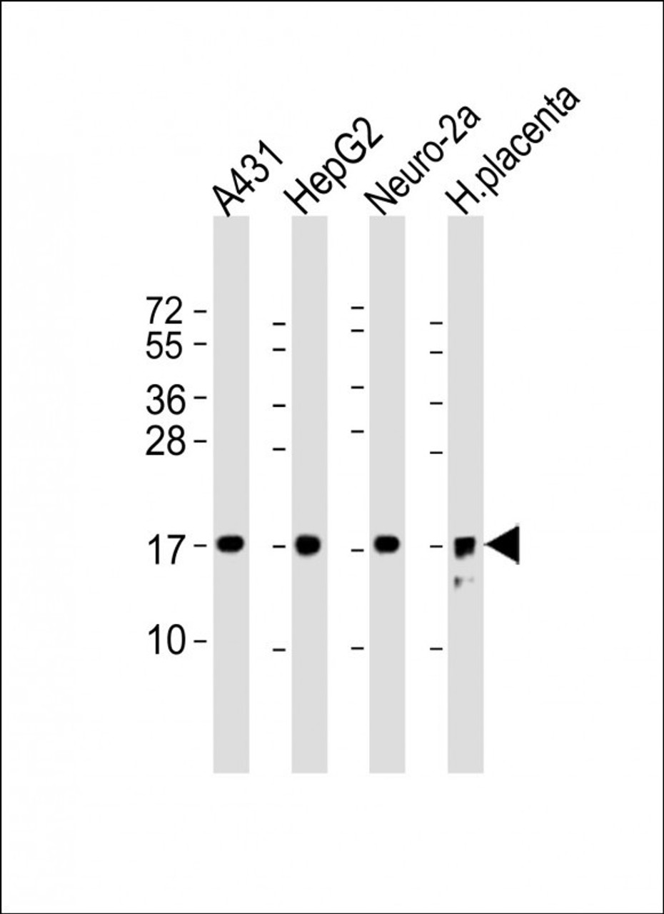 Western Blot at 1:2000 dilution Lane 1: A431 whole cell lysate Lane 2: HepG2 whole cell lysate Lane 3: Neuro-2a whole cell lysate Lane 4: human placenta lysate Lysates/proteins at 20 ug per lane.