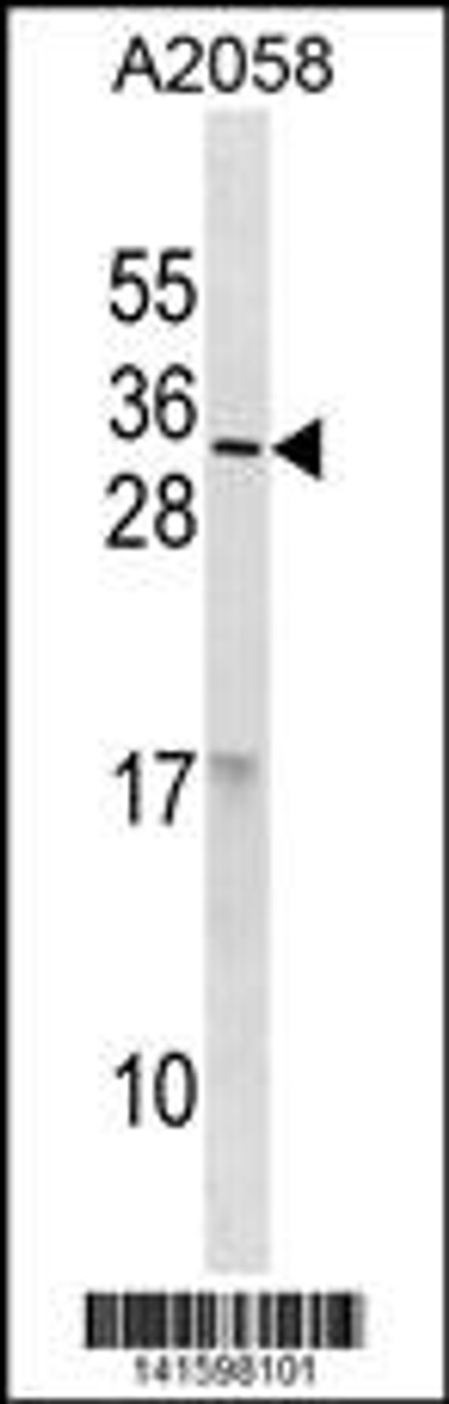 Western blot analysis in A2058 cell line lysates (35ug/lane) .