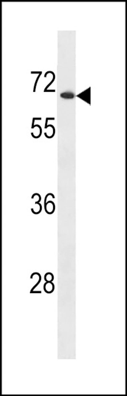 Western blot analysis in ZR-75-1 cell line lysates (35ug/lane) .