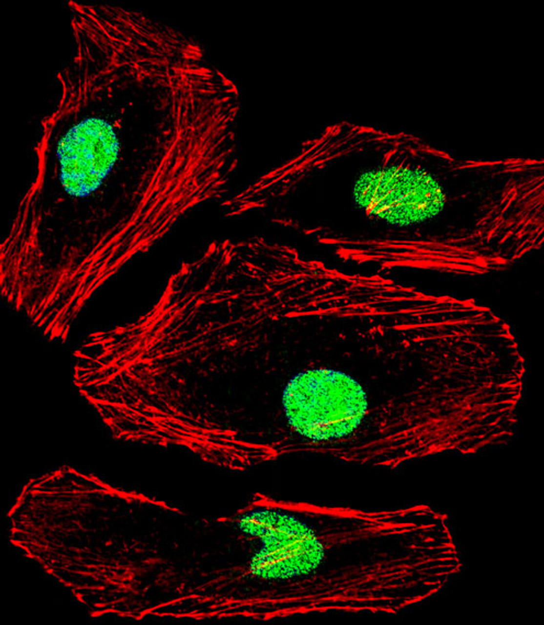 Fluorescent confocal image of Hela cell stained with MBD2 Antibody .Hela cells were fixed with 4% PFA (20 min) , permeabilized with Triton X-100 (0.1%, 10 min) , then incubated with MBD2 primary antibody (1:25) . For secondary antibody, Alexa Fluor 488 conjugated donkey anti-rabbit antibody (green) was used (1:400) .Cytoplasmic actin was counterstained with Alexa Fluor 555 (red) conjugated Phalloidin (7units/ml) . Nuclei were counterstained with DAPI (blue) (10 ug/ml, 10 min) .MBD2 immunoreactivity is localized to Nucleus significantly.