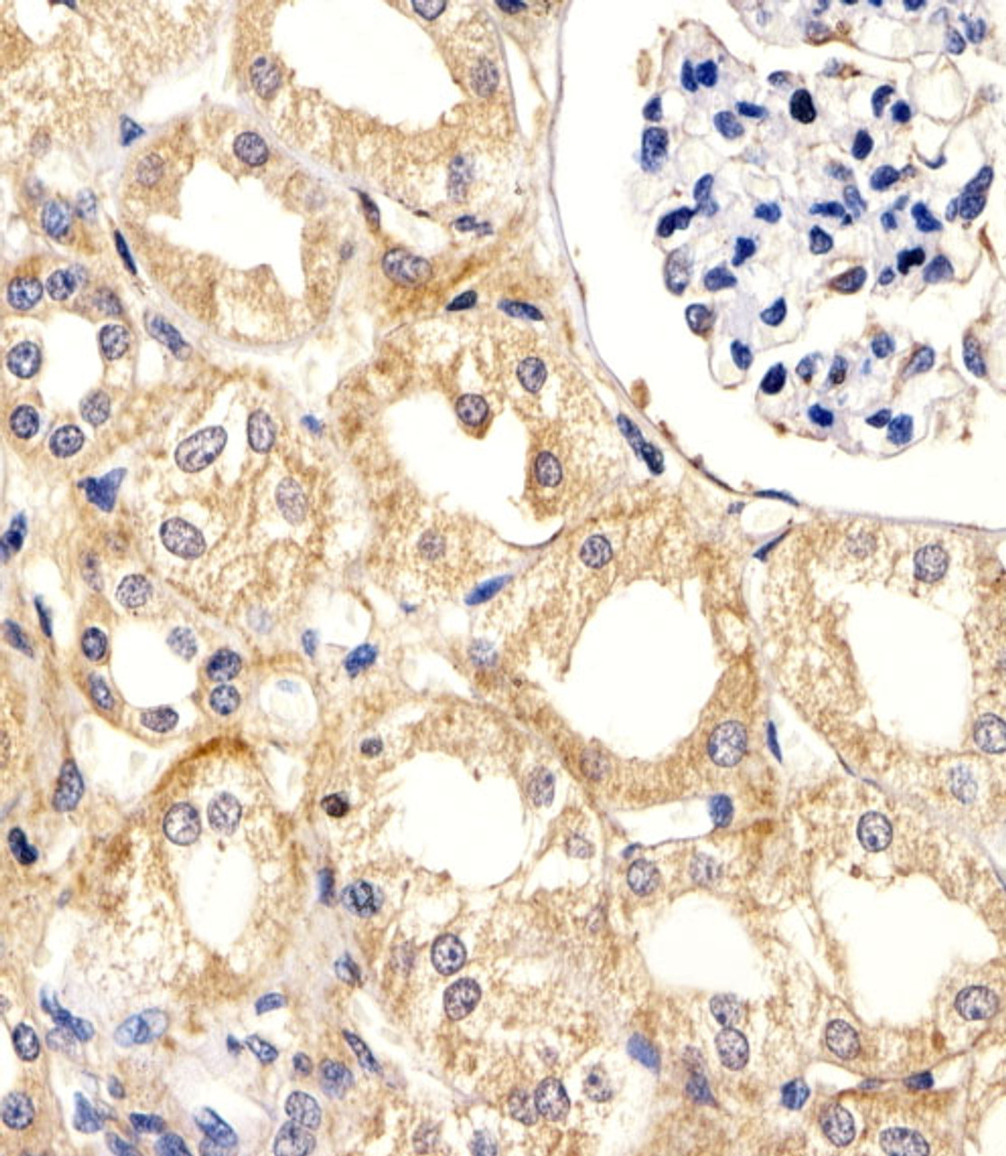Immunohistochemical analysis of paraffin-embedded H.kidney section using UBE2L3 Antibody . Antibody was diluted at 1:25 dilution. A peroxidase-conjugated goat anti-rabbit IgG at 1:400 dilution was used as the secondary antibody, followed by DAB staining.