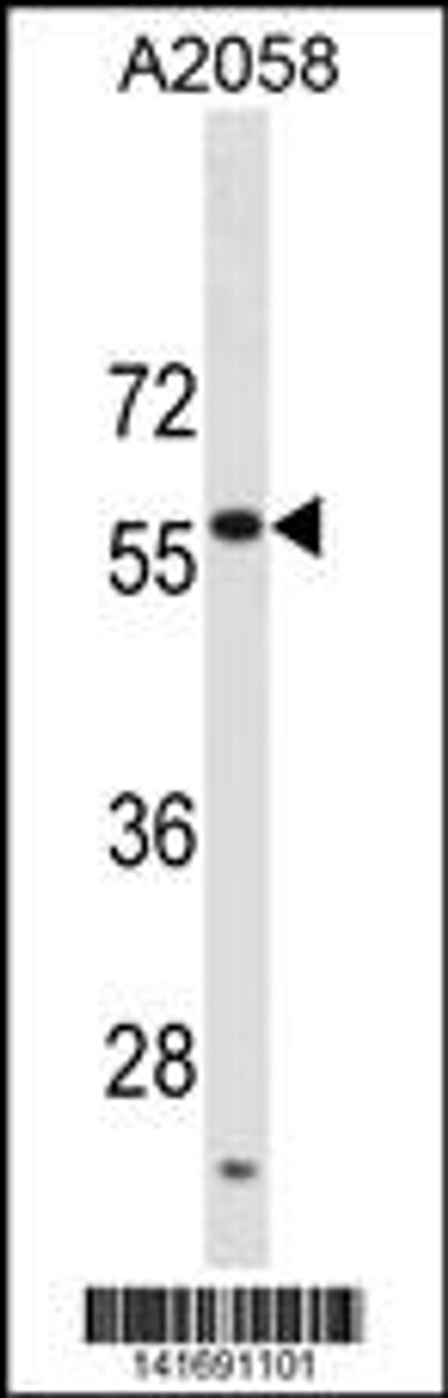 Western blot analysis in A2058 cell line lysates (35ug/lane) .