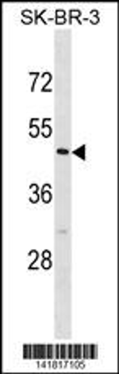 Western blot analysis in SK-BR-3 cell line lysates (35ug/lane) .