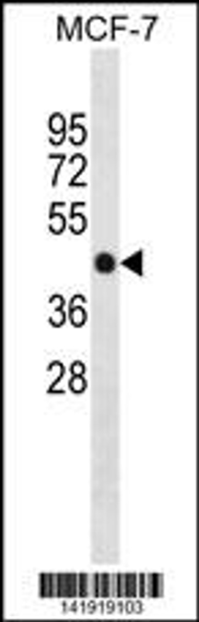 Western blot analysis in MCF-7 cell line lysates (35ug/lane) .