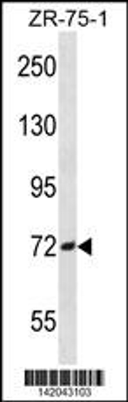 Western blot analysis in ZR-75-1 cell line lysates (35ug/lane) .