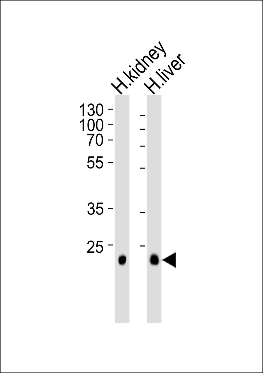 Western blot analysis of lysates from human kidney and liver tissue lysate (from left to right) , using CLDN14 Antibody at 1:1000 at each lane.