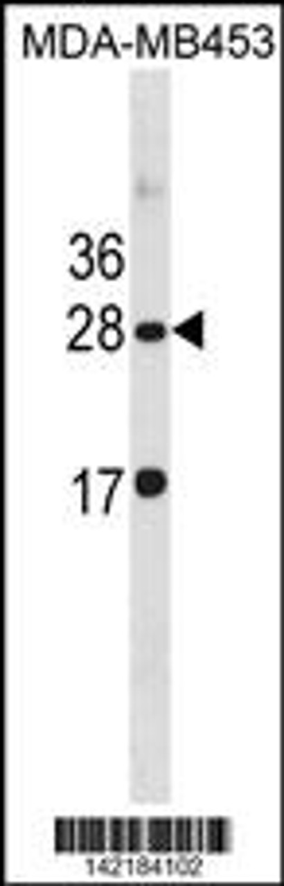 Western blot analysis in MDA-MB453 cell line lysates (35ug/lane) .