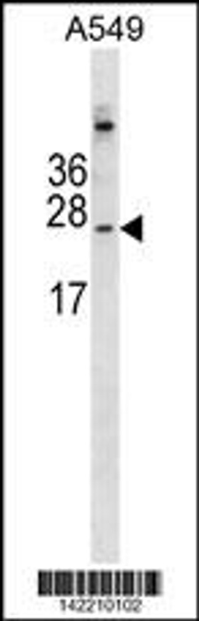 Western blot analysis in A549 cell line lysates (35ug/lane) .