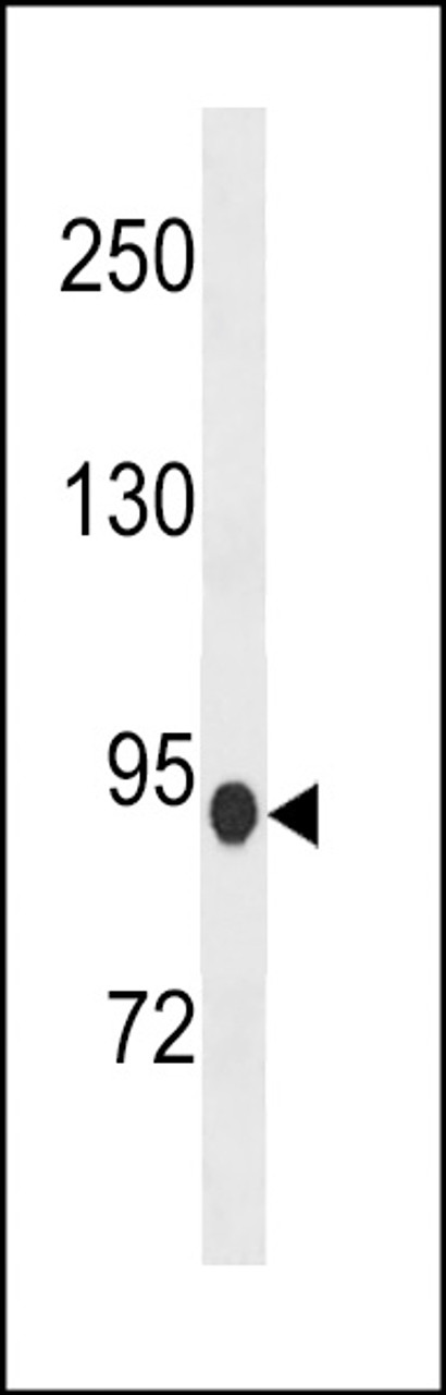 Western blot analysis in mouse heart tissue lysates (35ug/lane) .