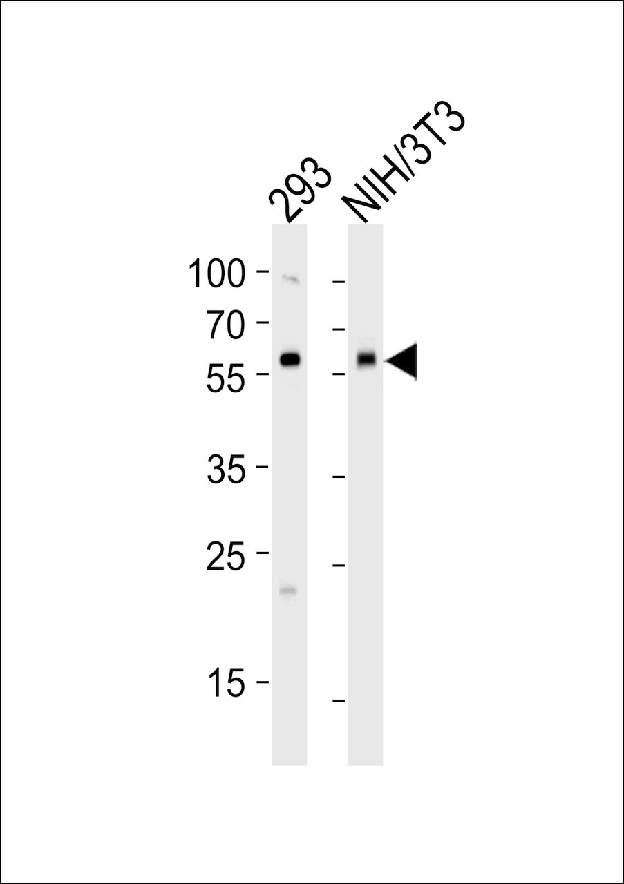 Western blot analysis of lysates from 293, mouse NIH/3T3 cell line (from left to right) , using BMPR1A Antibody (C180) at 1:1000 at each lane.