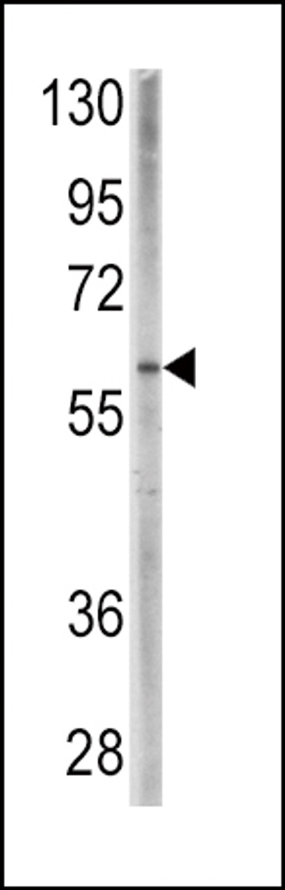Western blot analysis of anti-BMPR1A Pab in CEM cell line lysates (35ug/lane) .