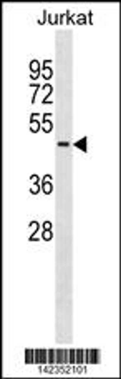 Western blot analysis in Jurkat cell line lysates (35ug/lane) .