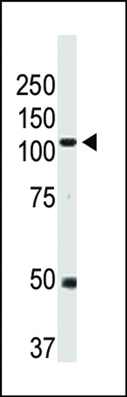 Western blot analysis of anti-BMPR2 Pab in mouse heart tissue lysate