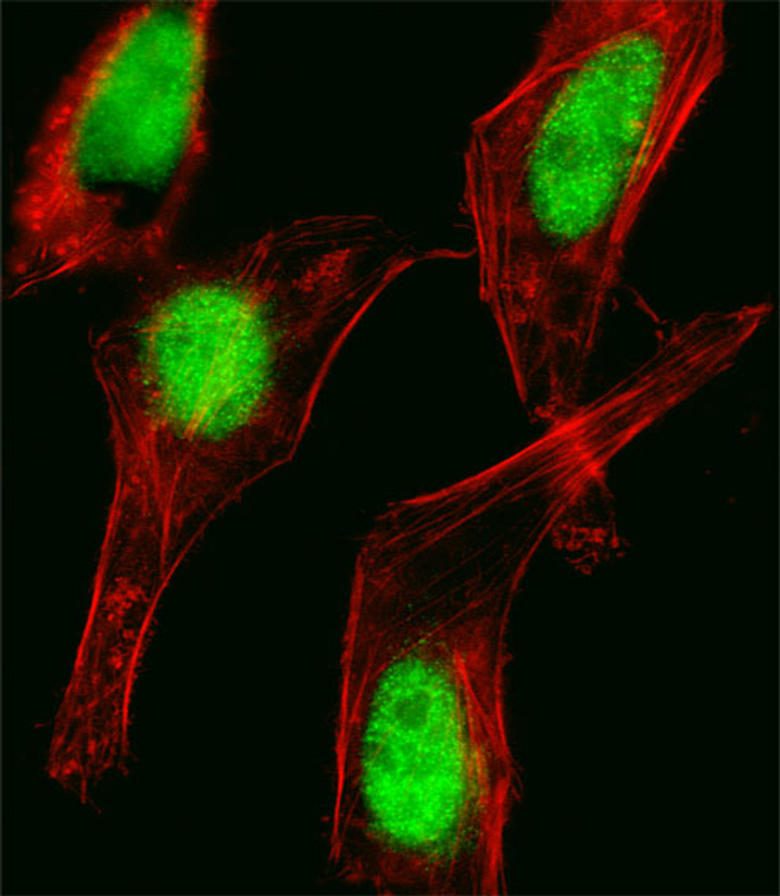 Fluorescent image of Hela cell stained with HOXC10 Antibody .Hela cells were fixed with 4% PFA (20 min) , permeabilized with Triton X-100 (0.1%, 10 min) , then incubated with HOXC10 primary antibody (1:25) . For secondary antibody, Alexa Fluor 488 conjugated donkey anti-rabbit antibody (green) was used (1:400) .Cytoplasmic actin was counterstained with Alexa Fluor 555 (red) conjugated Phalloidin (7units/ml) .HOXC10 immunoreactivity is localized to Nucleus significantly.