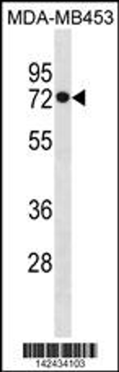 Western blot analysis in MDA-MB453 cell line lysates (35ug/lane) .