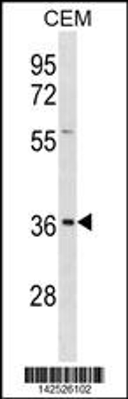 Western blot analysis in CEM cell line lysates (35ug/lane) .