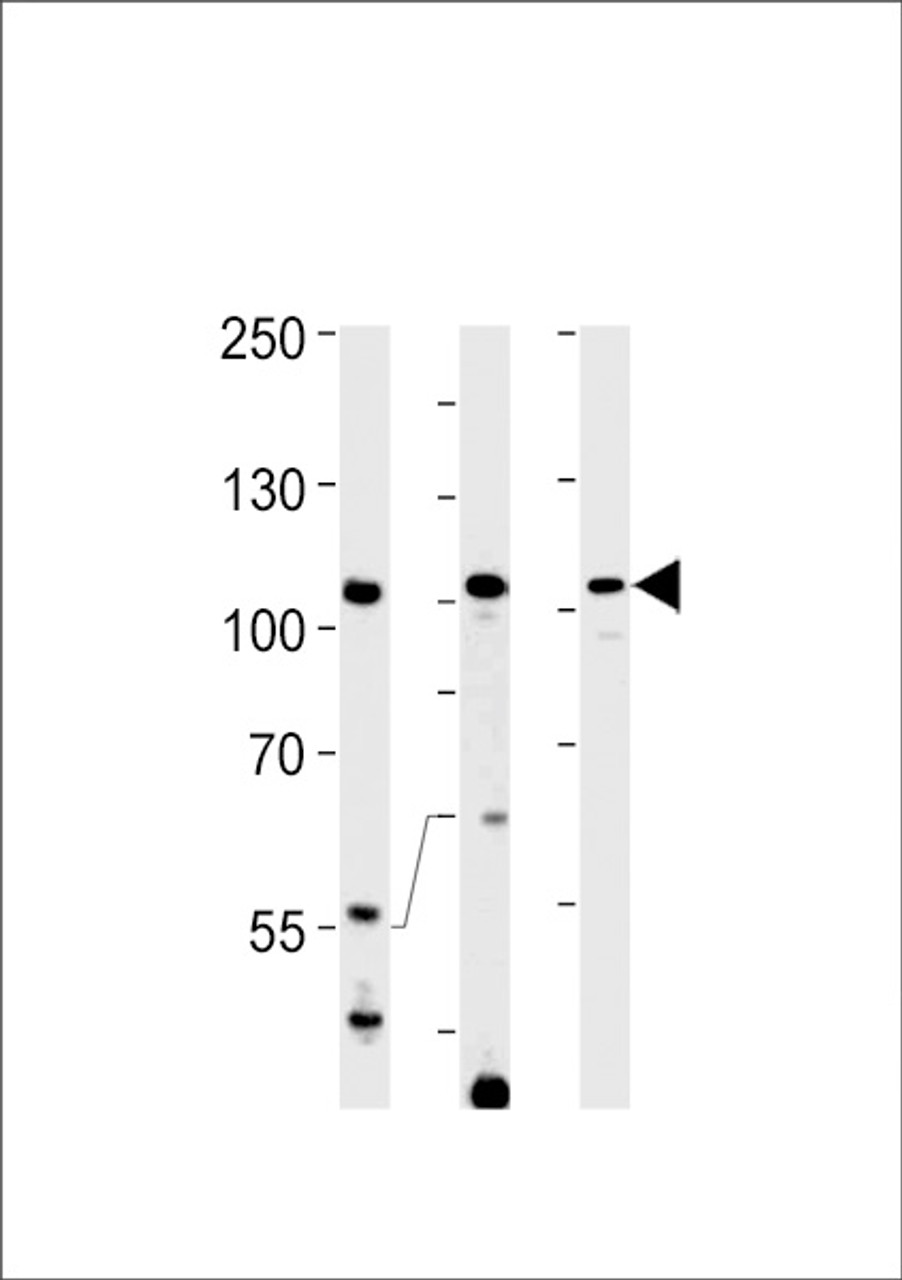 Western blot analysis in Hela，K562 cell line and rat spleen tissue lysates (35ug/lane) .This demonstrates the TFIP11 antibody detected the TFIP11 protein (arrow) .