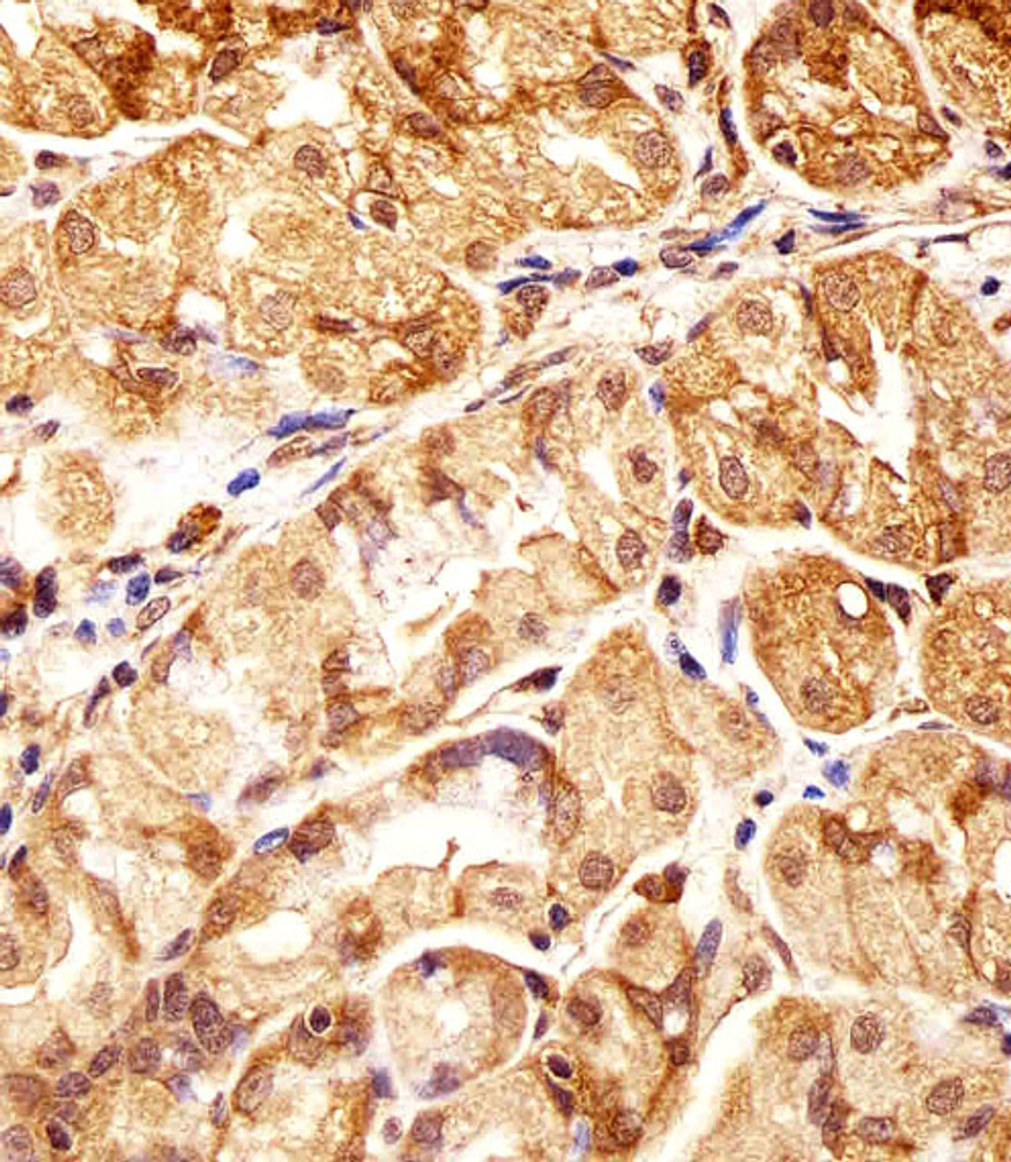 Immunohistochemical analysis of paraffin-embedded H. stomach section using POLDIP3 Antibody (N-term) . Antibody was diluted at 1:25 dilution. A undiluted biotinylated goat polyvalent antibody was used as the secondary, followed by DAB staining.