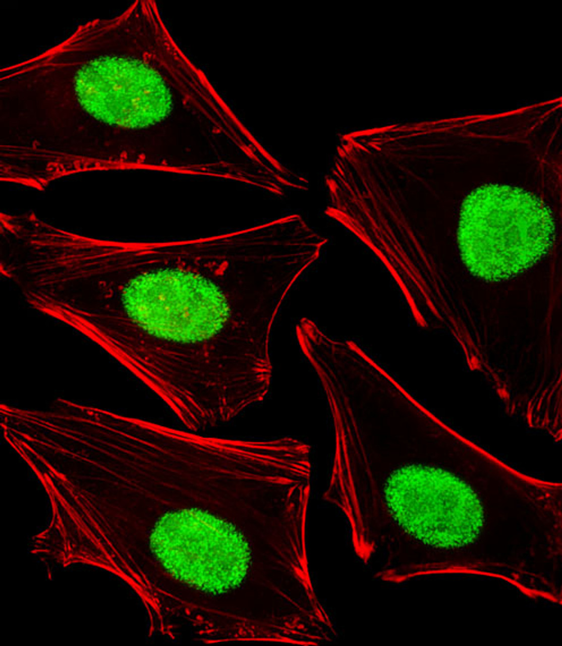 Fluorescent image of Hela cells stained with POLDIP3 Antibody (N-term) . Antibody was diluted at 1:25 dilution. An Alexa Fluor 488-conjugated goat anti-rabbit lgG at 1:400 dilution was used as the secondary antibody (green) . Cytoplasmic actin was counterstained with Alexa Fluor 555 conjugated with Phalloidin (red) .