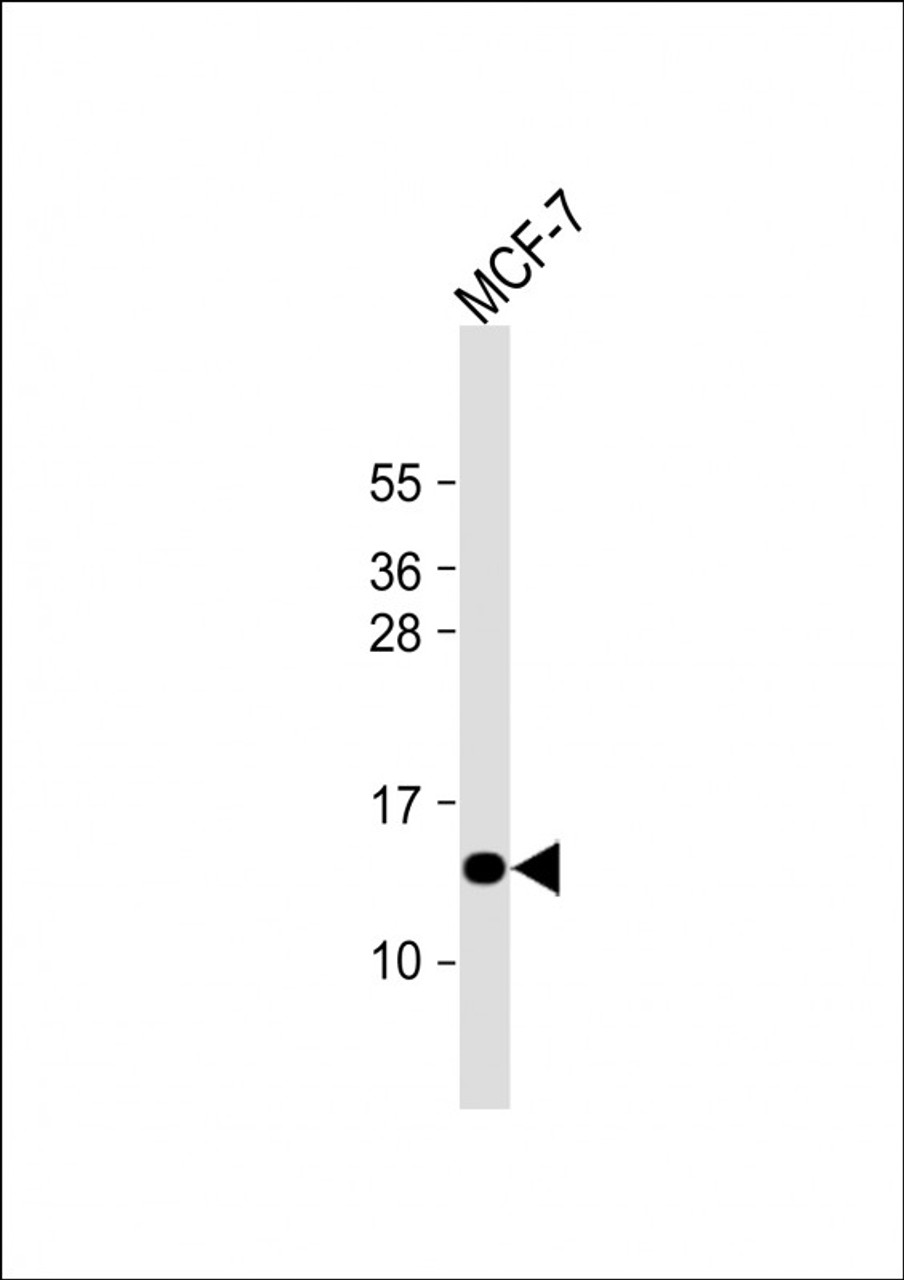 Western Blot at 1:1000 dilution + MCF-7 whole cell lysate Lysates/proteins at 20 ug per lane.