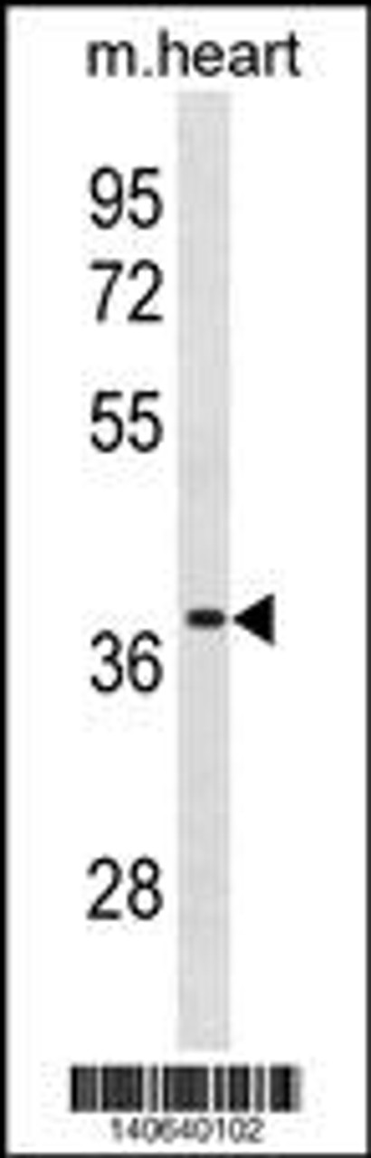 Western blot analysis in mouse heart tissue lysates (35ug/lane) .