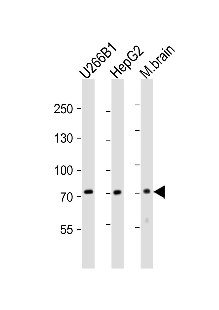 Western blot analysis of lysates from U266B1, HepG2 cell line, mouse brain tissue lysate (from left to right) , using NT5E-M535 Antibody at 1:2000 at each lane. Lysates at 20ug per lane.